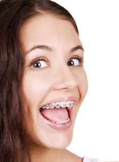 Orthodontics Forney TX