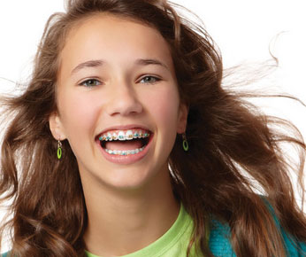 metal braces Orthodontics Forney TX metal braces Orthodontics Forney TX