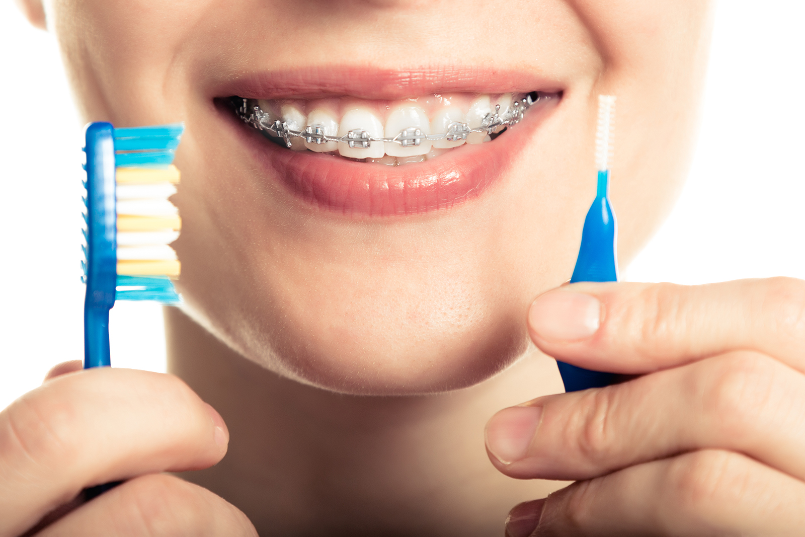 Ask Your Forney Dentist: What Are Some Must-Haves for Cleaning Braces and Aligners?